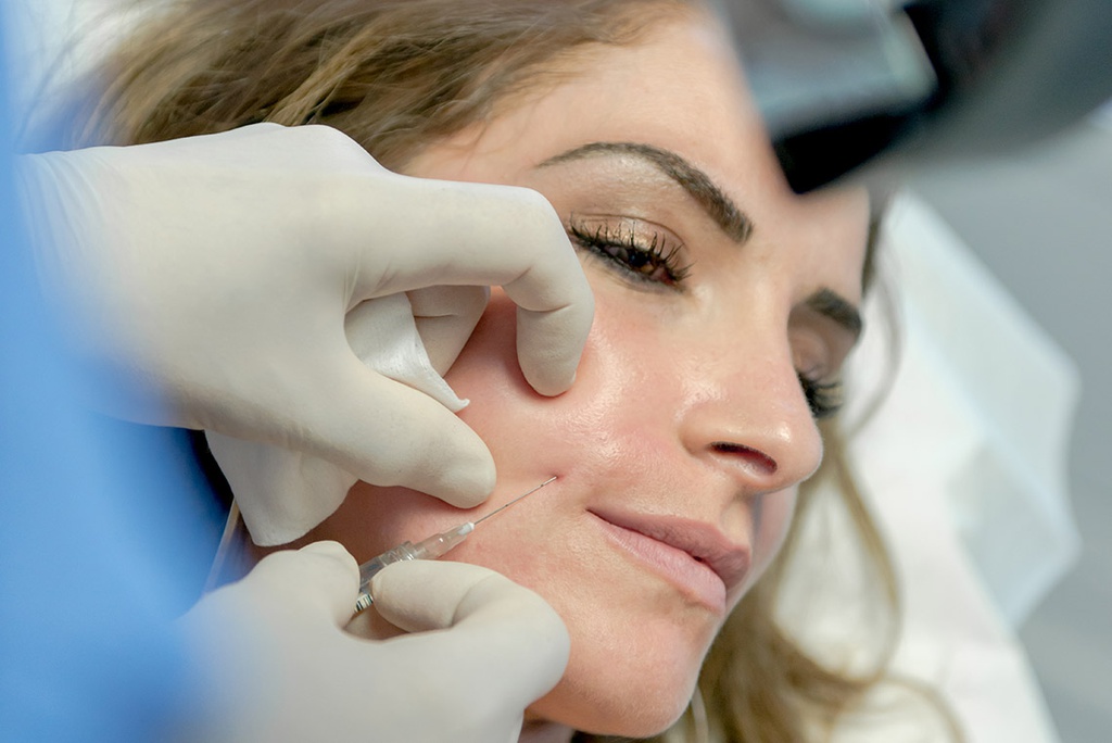 LA MESOTHERAPIE