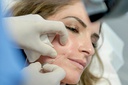 LA MESOTHERAPIE