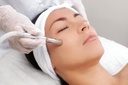 Dermabrasion Visage