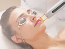 Epilation Visage Complet au Laser (Sans le Cou)